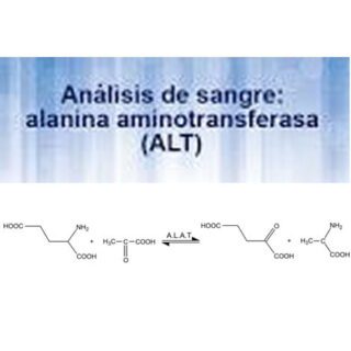 ALT/GPT (ALTL) Transaminasa Pir?vica